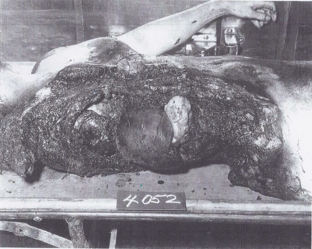 This is Dr Mary Sherman, likely victim of "Spontaneous Human Combustion" which is code for Directed Energy Weapons that can insta-char flesh.  DR MARY'S MONKEY explains her demise as being likely to a silencing and cover-up of the weaponization of cancer.  Involves JFK, Oswald, Tulane Univ, Judyth Vary Baker, Natl Cancer Institute, Military.